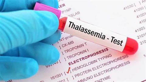 Thalassemia (Tan máu bẩm sinh)